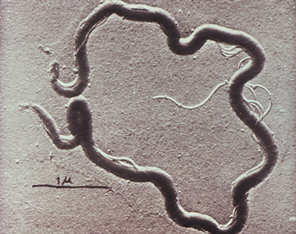 Syphilis Topic of February Kaler Science Talk